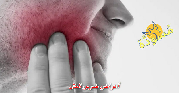 أعراض ضرس العقل